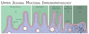 celiac-disease